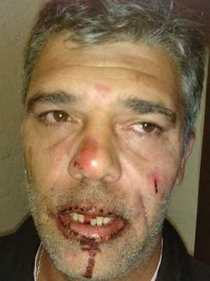 Así quedó el rostro del periodista tras la agresión