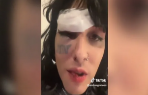 Andrea contó lo ocurrido en un video de su cuenta de Tik Tok, donde se pueden observar las lesiones sufridas.